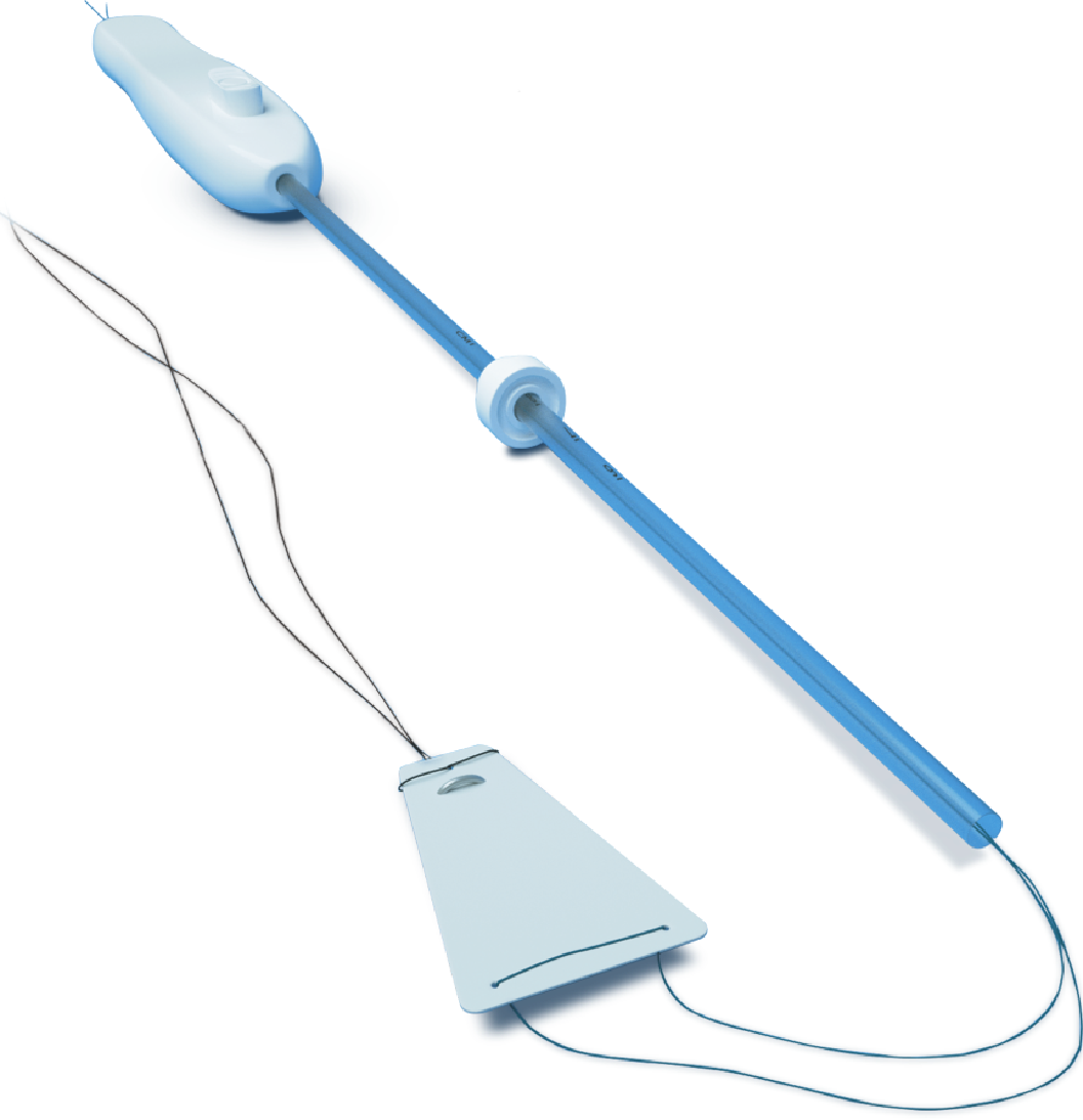 coina iud